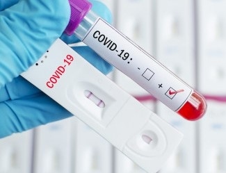 1127 са новите случаи на коронавирус у нас
